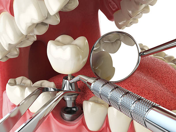 Best Emergency Dental Filling Replacement  in Olympia Fields, IL